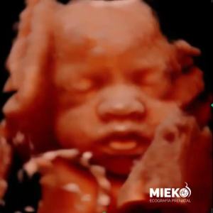 Mieko Classic